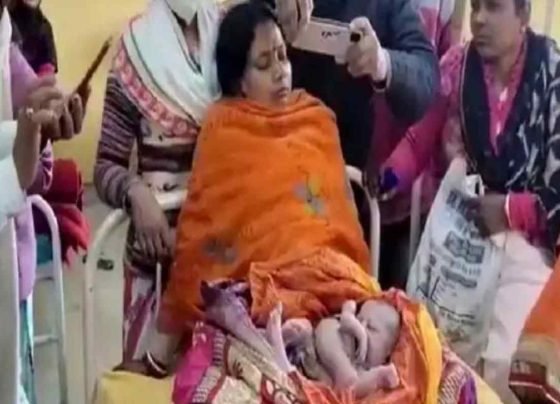 woman gave birth 4 Legged Baby Girl in madhya pradesh