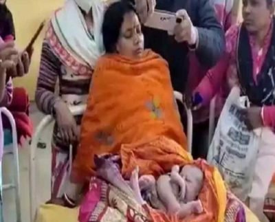 woman gave birth 4 Legged Baby Girl in madhya pradesh